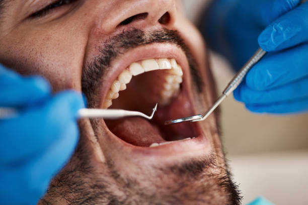 Best Emergency Tooth Extraction in Newfield, NJ